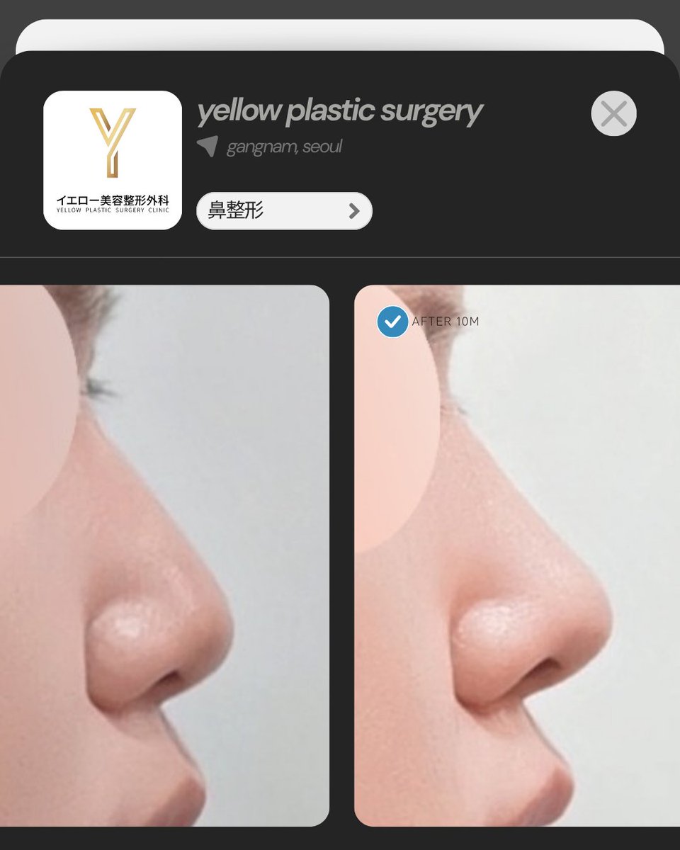 💛イエロー美容整形外科(公式)💛 tweet media