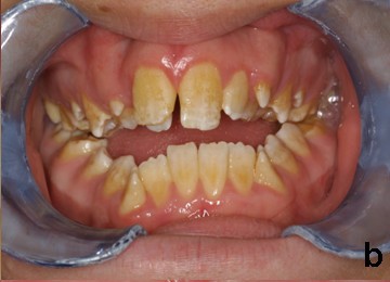 Journal of Dental Health & Oral Research tweet media