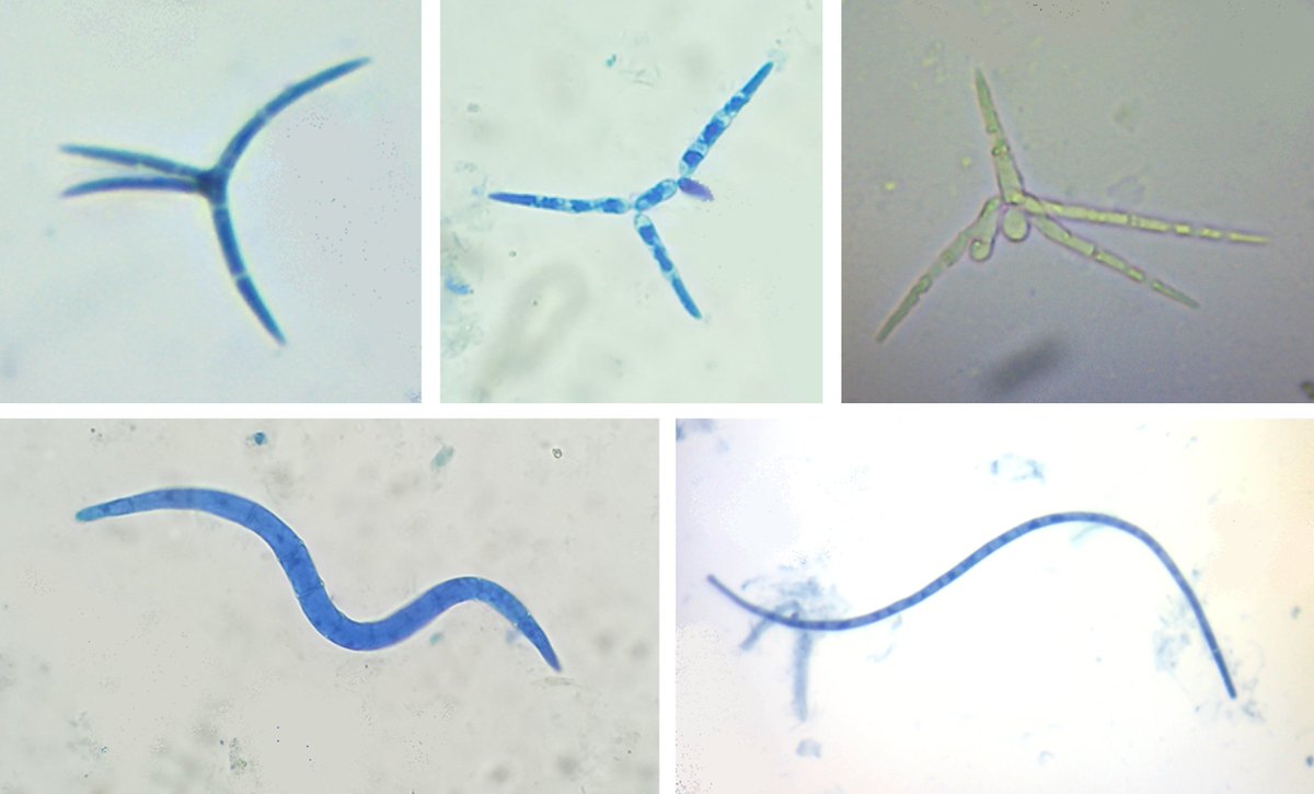BritMycolSoc's tweet photo. Fun with aquatic hyphomycetes: Fay Newbery's @FayrnHawk Field Mycology article is an engaging introduction to this understudied group of microscopic fungi, which break down plant material &amp; prevent clogged waterways. See the treasures in river foam here: https://t.co/waXAtSRa19 https://t.co/O66wbkHvHq