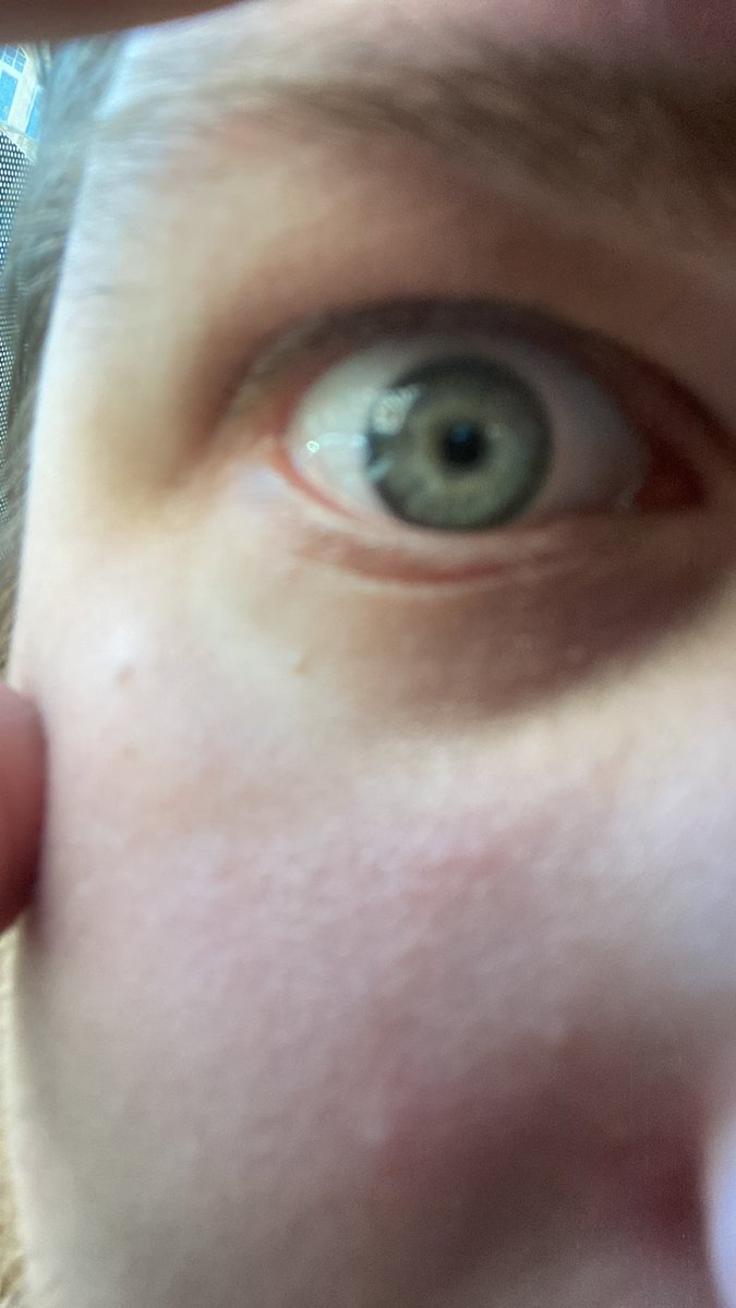 Ptačí muž - Výkřik Robespierra tweet media