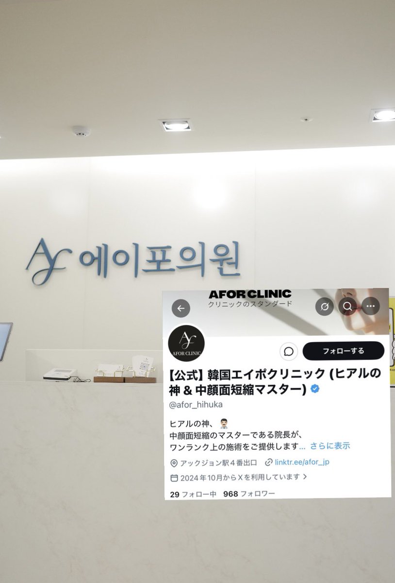 ykss_2141's tweet photo. ここまで1回のヒアルロン酸で感動することは多分もうない………頬骨が張ってて輪郭ピーナッツ🥜コケて見えるのが悩みで狎鴎亭にあるヒアルが得意なエイポクリニックに。超丁寧にデザインしてくれて痛みもほぼ無しだし上手すぎでは…？人違うレベルに輪郭変わった。頬コケ悩んでる人に本当おすすめ… https://t.co/fchquh6JcO