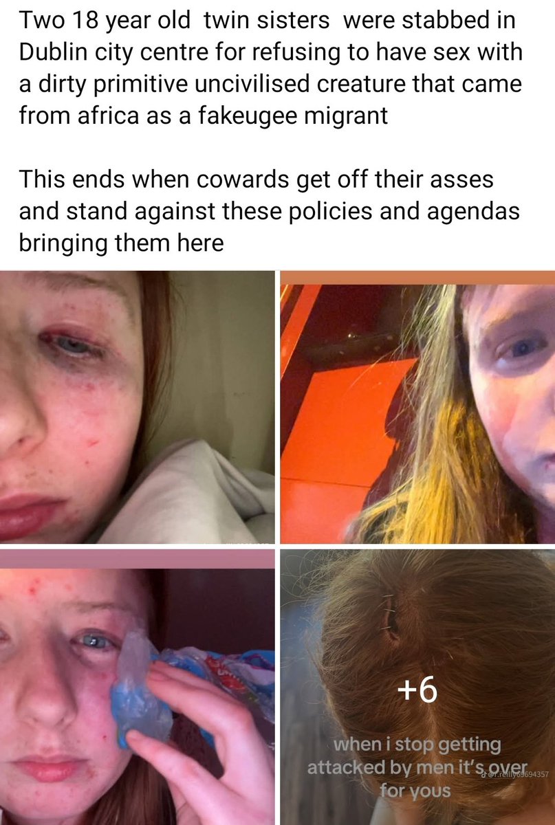 Louise McKenna tweet media