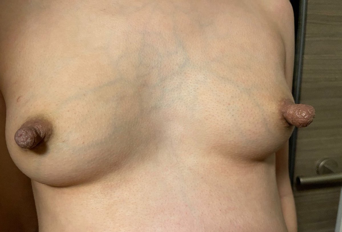 代孕奴 tweet media