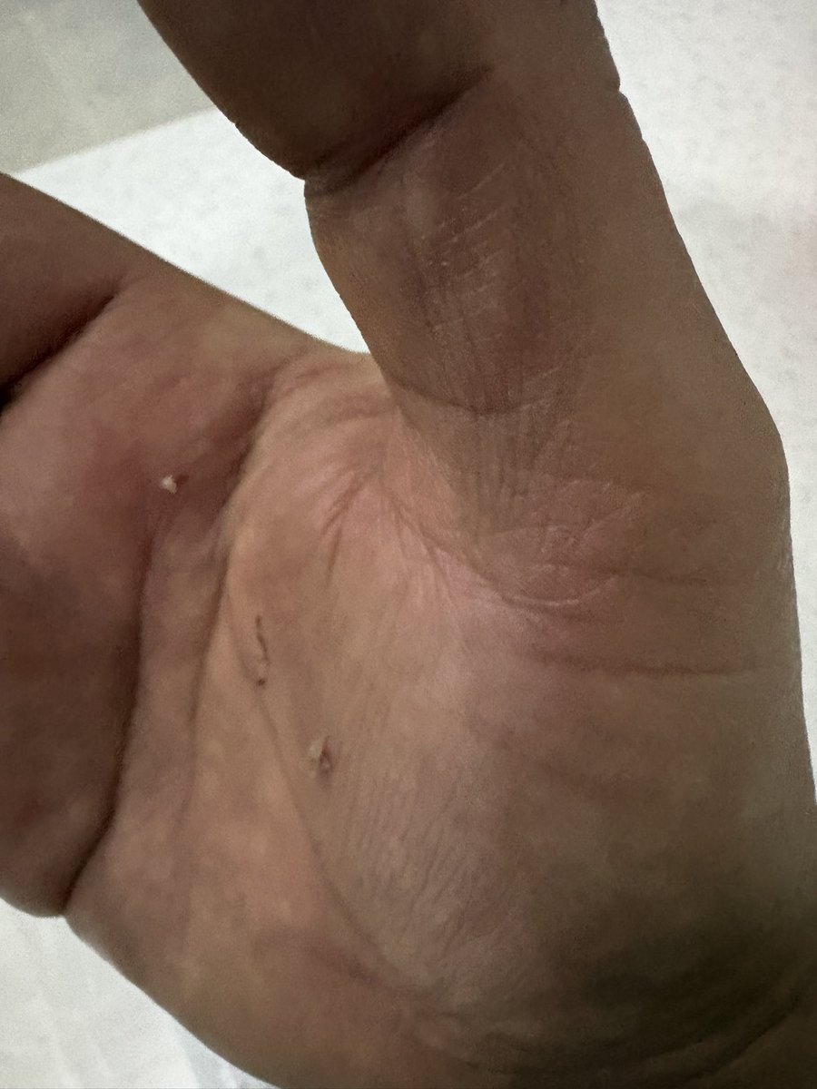 Alexsinho tweet media