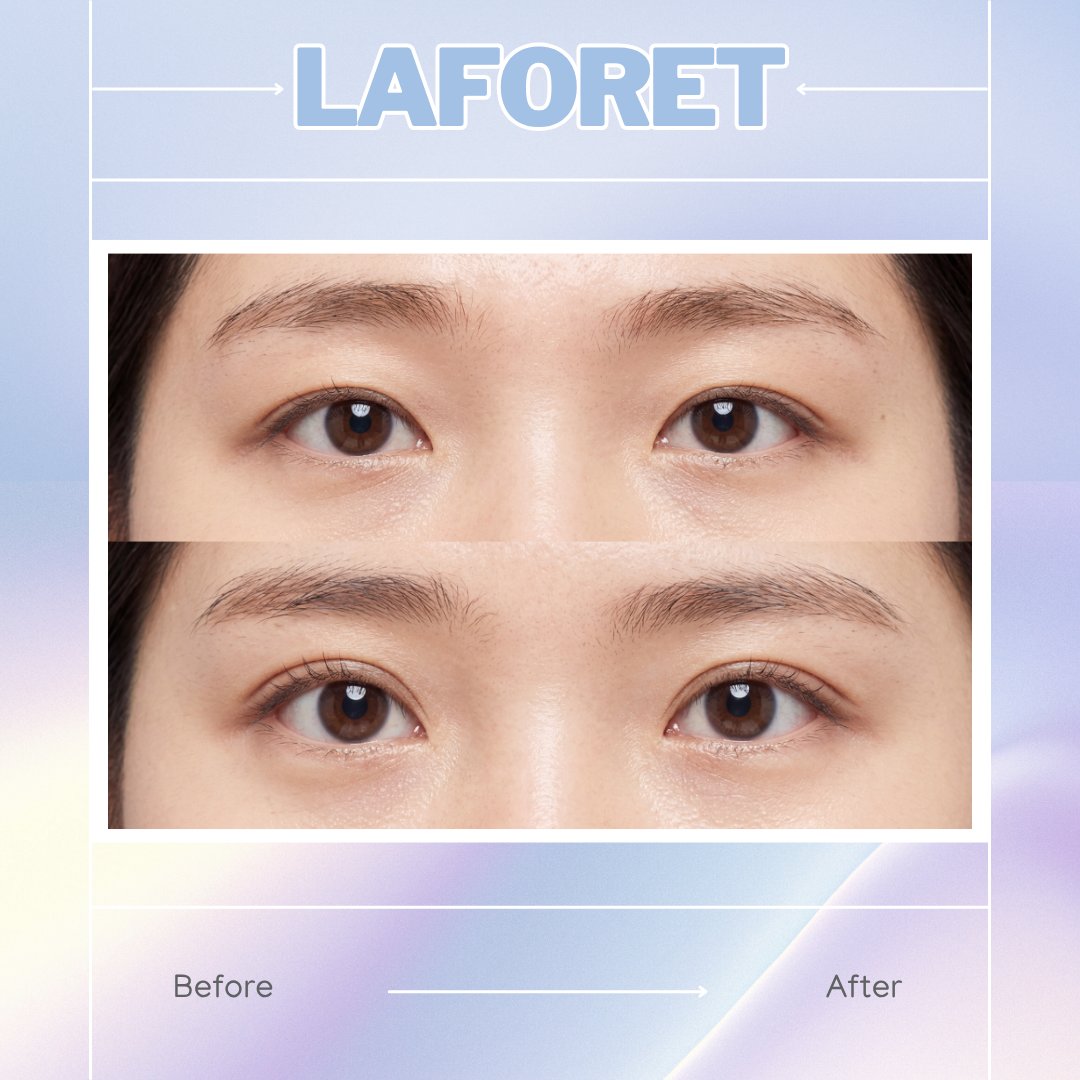 【韓国整形】ラフォーレ美容外科 tweet media