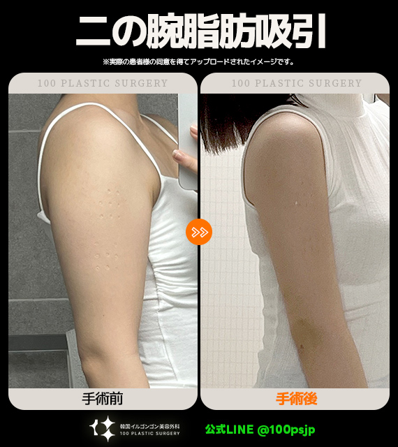 韓国イルゴンゴン美容外科 tweet media