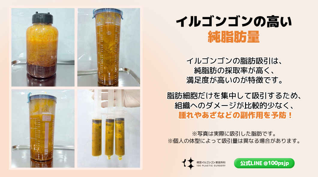 韓国イルゴンゴン美容外科 tweet media