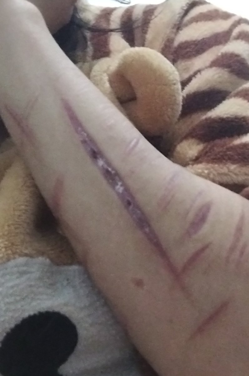 sᴛᴜᴘɪᴅ ♡ tweet media