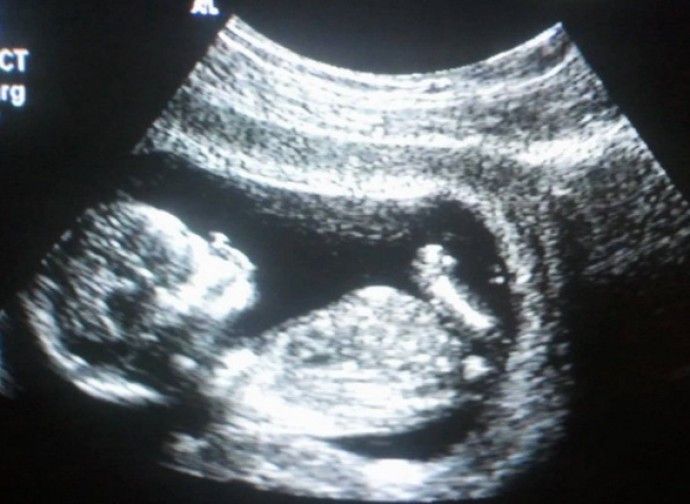 #aborto , altri 65 mila bambini uccisi. E si vendono più pillole

Il Ministero della Salute ha presentato il suo rapporto annuale sullo stato di attuazione della legge 194: 65.746 gli aborti ufficiali nel 2023. Nuovo record per la vendita...

»🗞buff.ly/yrY1ZW9