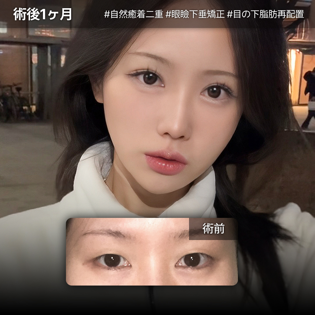 ルーヴル美容外科 tweet media