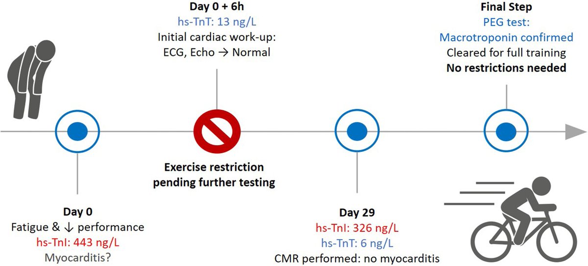 Sports_CardioNL's tweet photo. False-positive troponin in a professional cyclist: a case report on avoiding misdiagnosis and unnecessary restrictions
https://t.co/u8lf9SCMHt
#cardiactroponin #myocarditis #sportscardiology https://t.co/AogspNWEnD