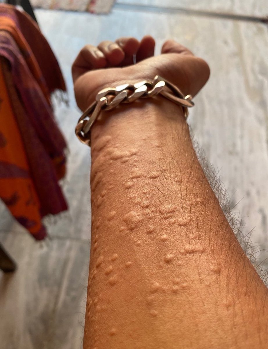 MELEK ÖZDEMİR tweet media