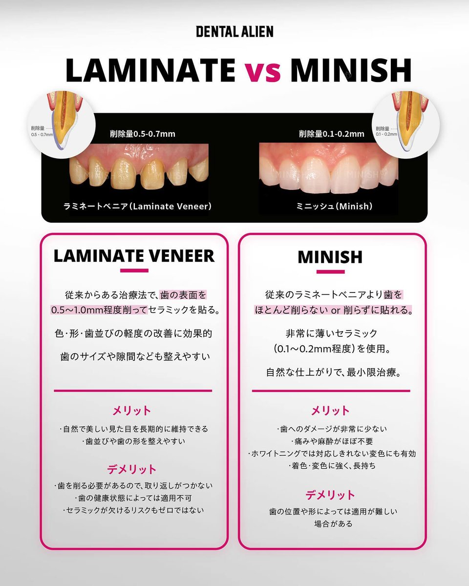 DENTAL ALIEN@ミニッシュ認定歯科 tweet media