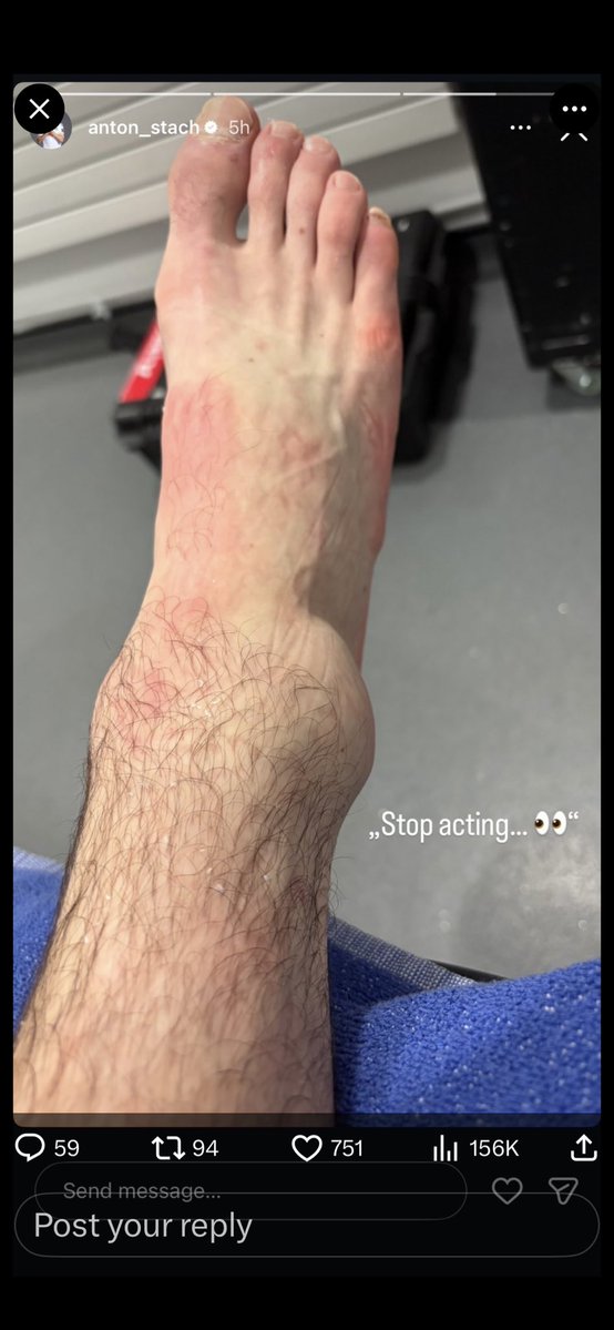 LowfieldsLedgeLs11 #LUFC #Bielsalista 💙💛🤍 tweet media