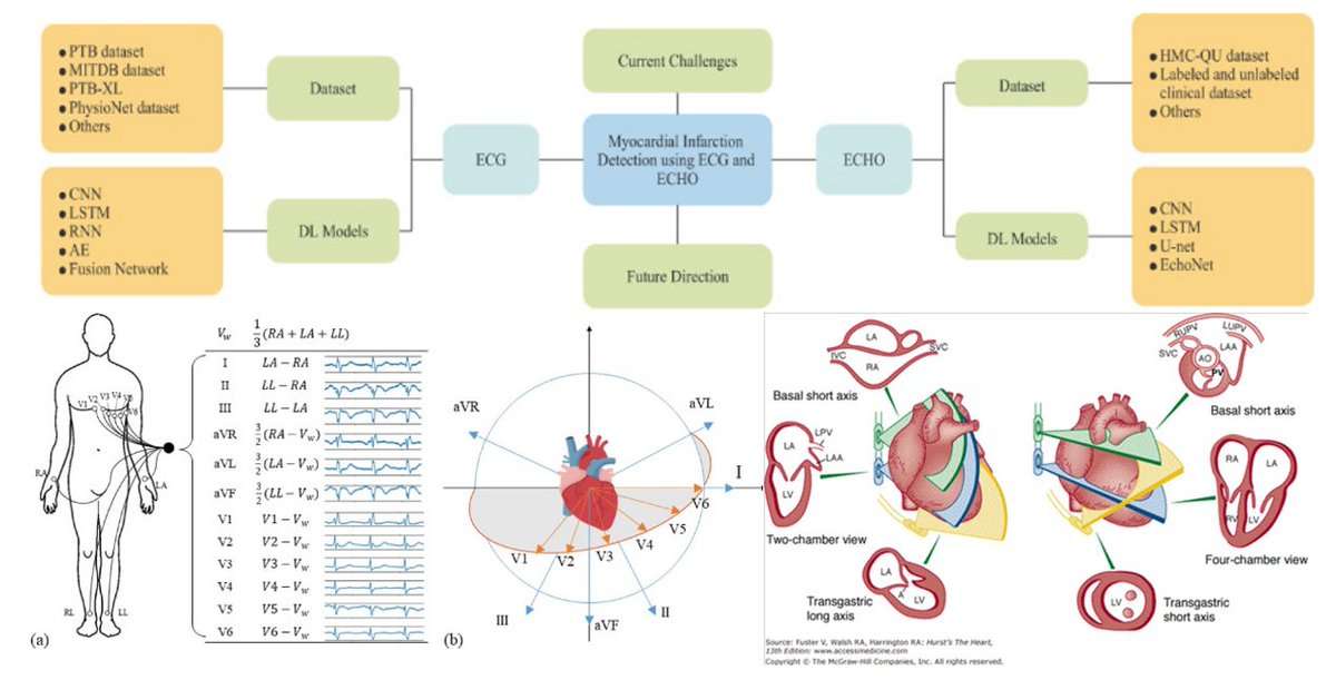 Deep learning-based approaches for myocardial infarction detection: A ...