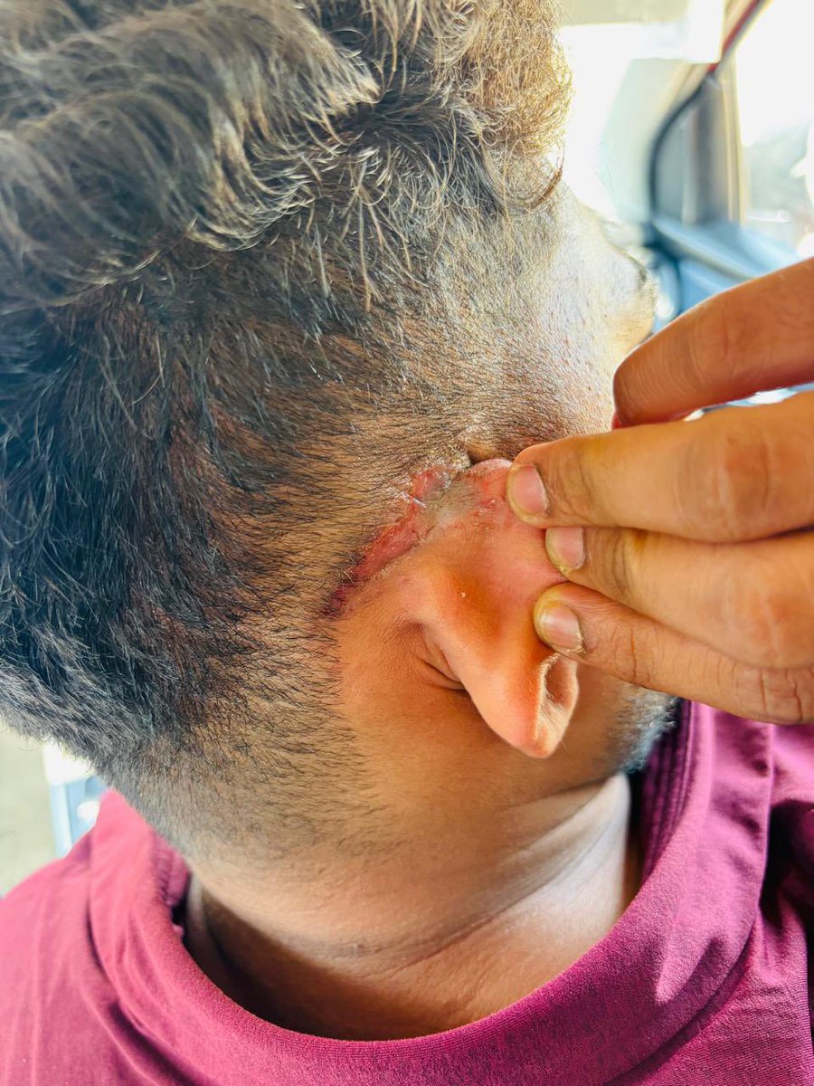 Antoniee tweet media