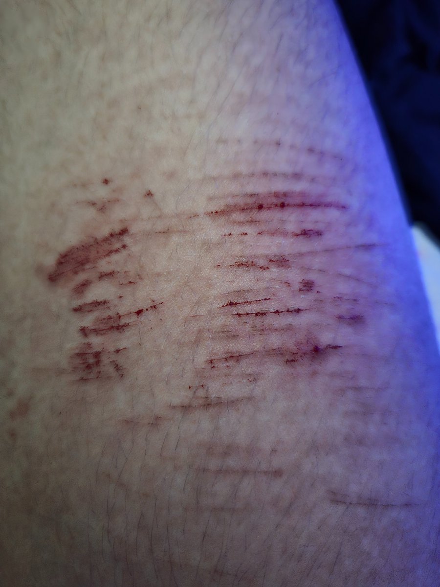 t1red4ever's tweet image. blep #shtwt #slittwt i wonder when ill be cutspo when all i do is cat scratches