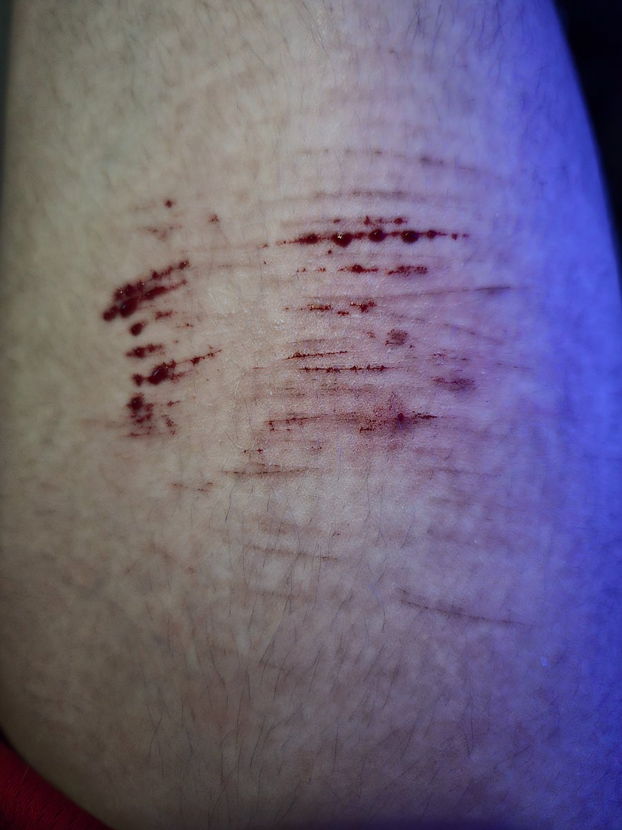 t1red4ever's tweet image. blep #shtwt #slittwt i wonder when ill be cutspo when all i do is cat scratches