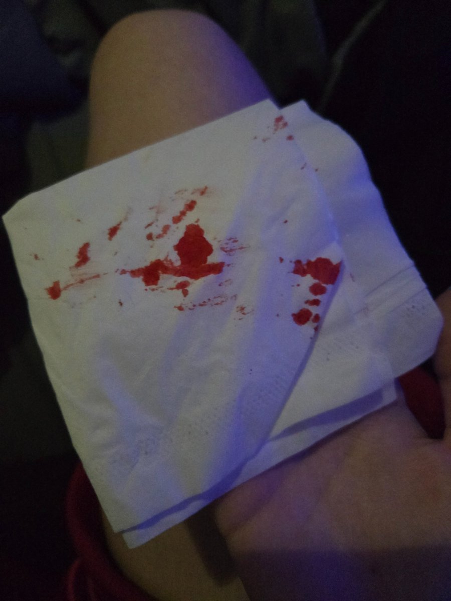 t1red4ever's tweet image. blep #shtwt #slittwt i wonder when ill be cutspo when all i do is cat scratches