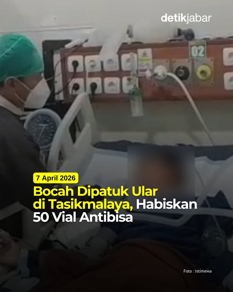 detikjabar_'s tweet photo. DK (12), seorang anak asal Kampung Borolong, Desa Cilampung hilir, Kec. Padakembang, Kab. Tasikmalaya dipatuk ular pada Minggu (29/3). Ia dipatuk saat tidur tidur bersama ibunya.

FULL : https://t.co/svbwc6sCo2 https://t.co/e0jJINVVLZ