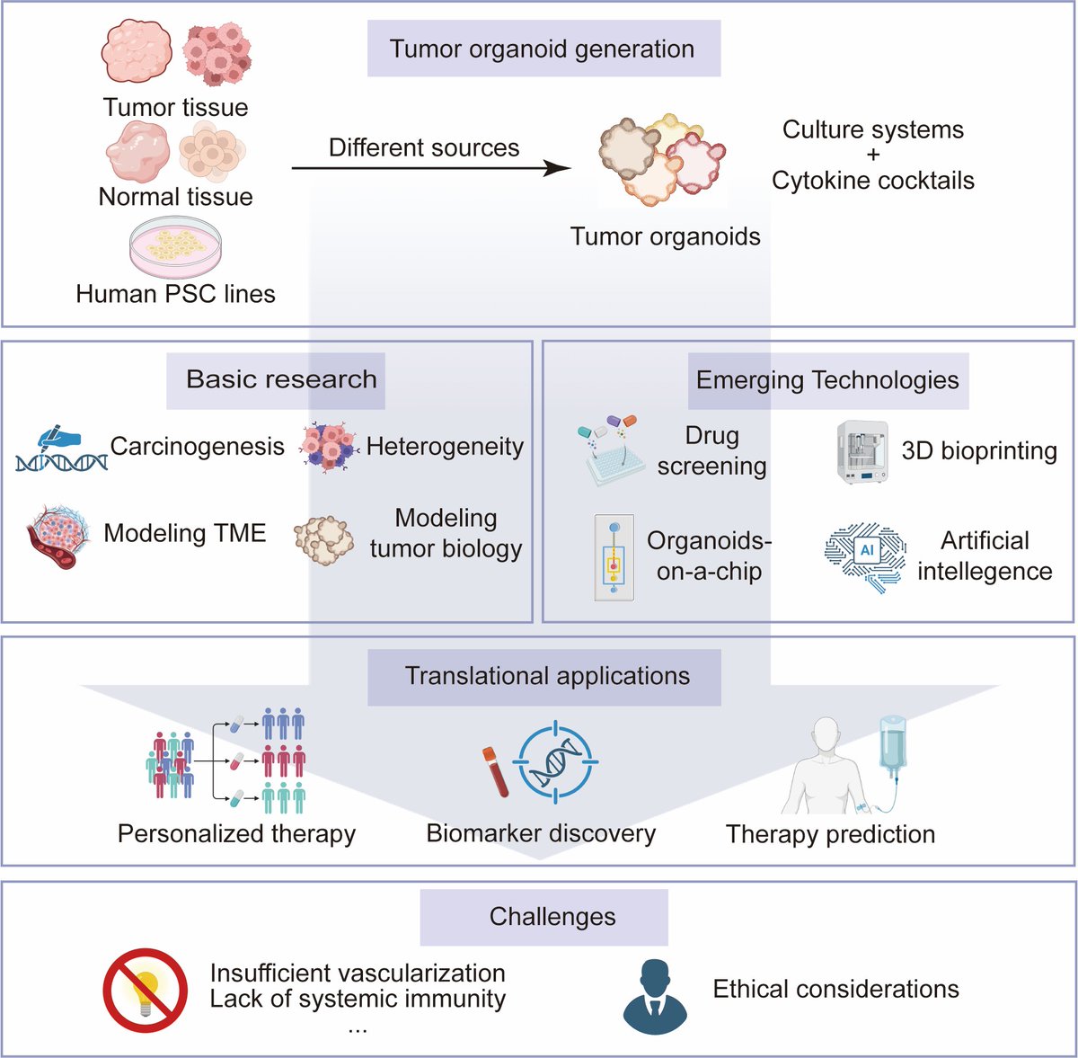 Protein_Cell's tweet photo. This review covers tumor organoid sources, establishment and culture systems, modeling carcinogenesis, heterogeneity, evolution and metastasis, tumor microenvironment reconstruction, clinical translation and trials and remaining challenges, standardization, ethics, and future directions.https://t.co/RYvkRsjGhq
