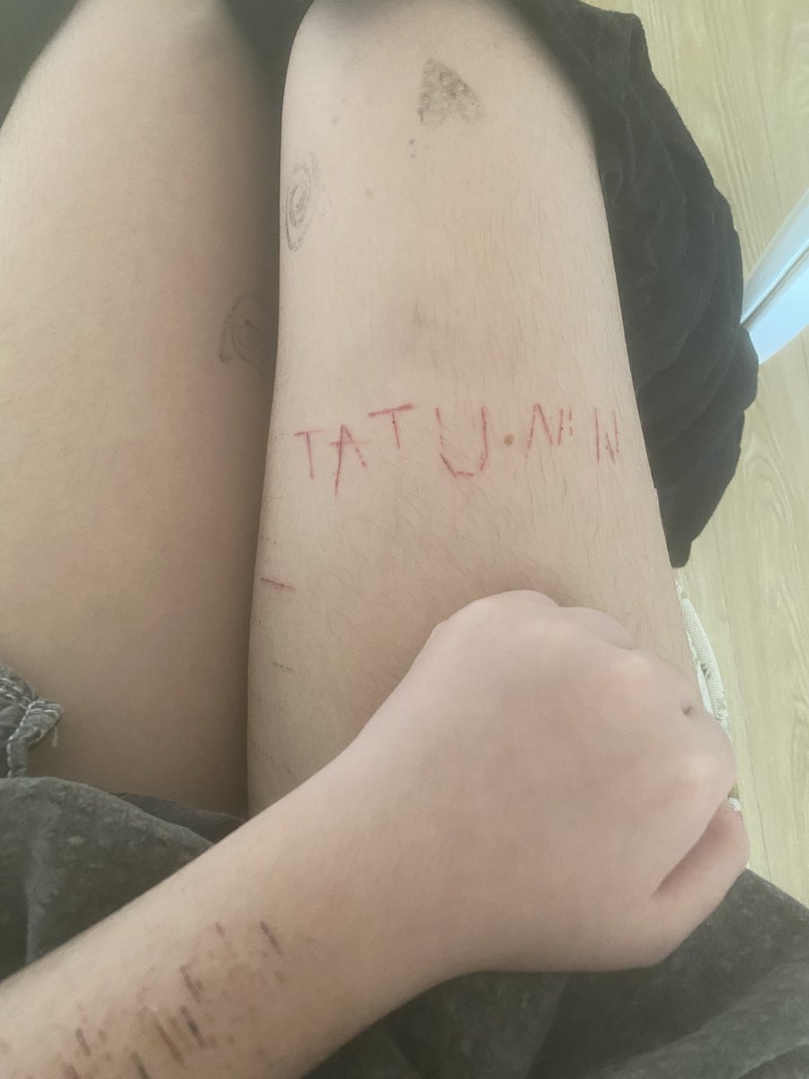 EmmaLovesToCry's tweet image. #shtwt 

Im the most annoying person you will ever know.