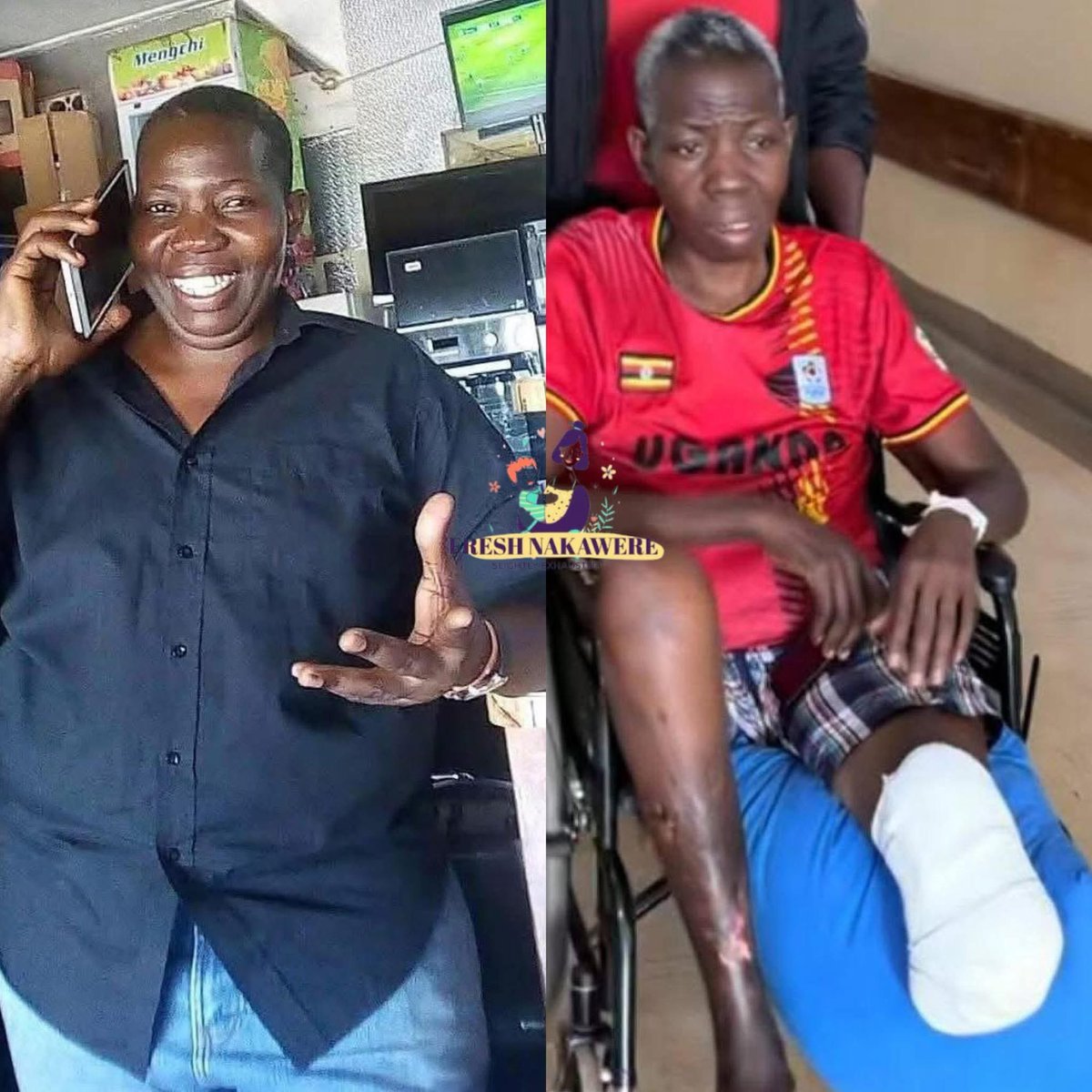 Ibrahim Musisi had a lovely marriage until DNA test proved that he is not the father of his children.

He lost weight from 120kg to 60kg in just a week.He lost his wife and children.

Diabetes added salt to his wounds and now he has lost his leg that was cut off to save his life