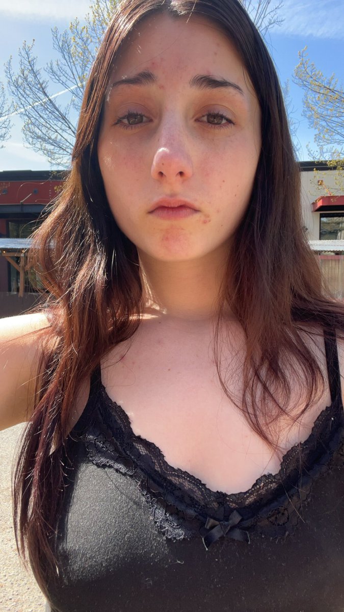 prettyskinny tweet media