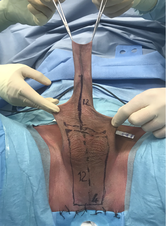 Ir. IPGSPR tweet media