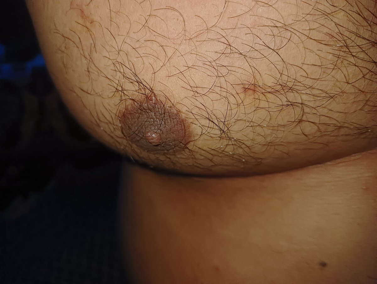 Ridho kurwis tweet media