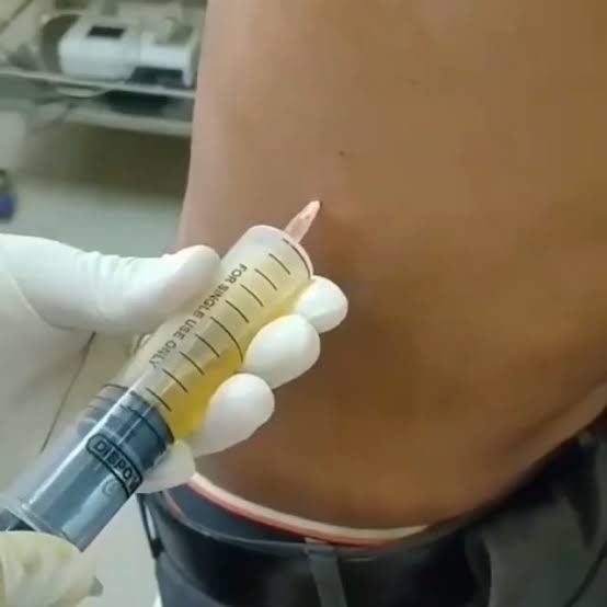 Яizal do tweet media