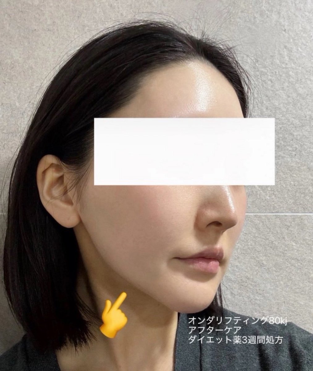 よう🇰🇷 tweet media