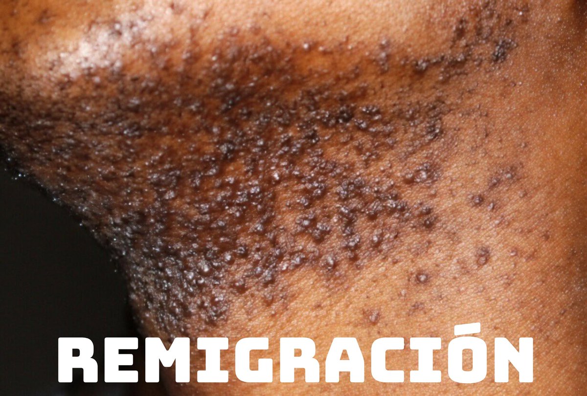 ⚒️⚙️ 𝔓𝔯𝔦𝔪𝔢𝔯𝔞 𝔏𝔦́𝔫𝔢𝔞 ⚙️⚒️ tweet media