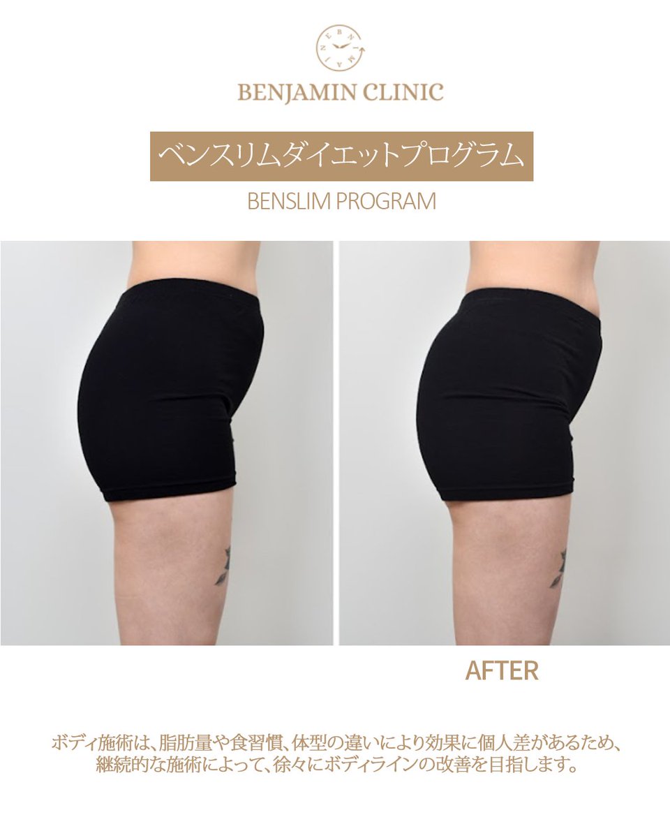 【韓国美容】ベンジャミンクリニック tweet media