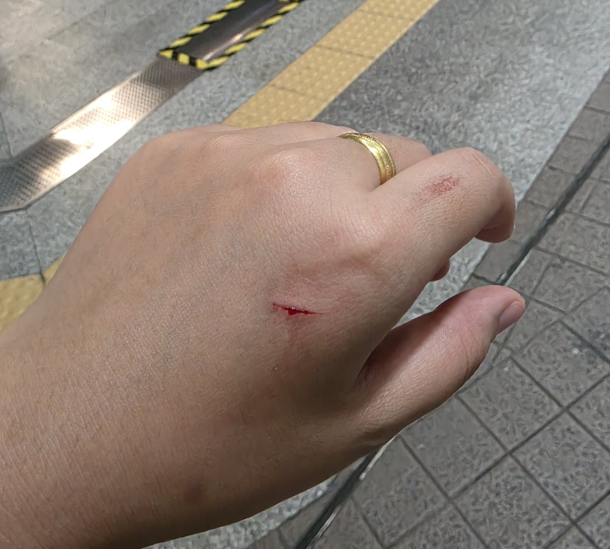 napatpim tweet media