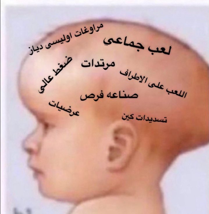 علي | #متصدر لا تكلمني tweet media