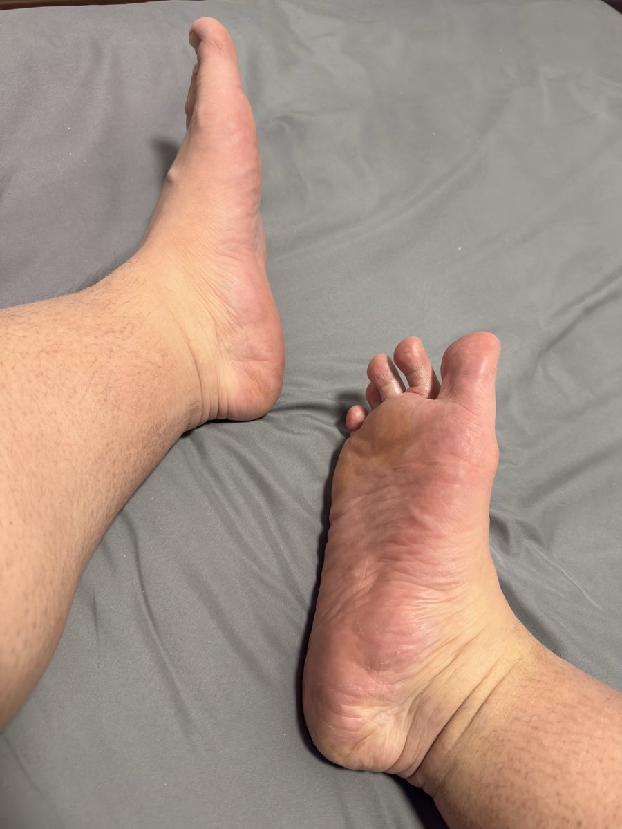stargod725's tweet photo. 好久没看见老子的臭脚底了吧？狗东西们，还不张开狗嘴，使劲舔！ https://t.co/lipFWBuYdr