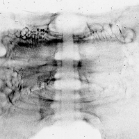 PhysRevLett's tweet image. Experimental demonstration of the radial acceleration of protons in a low-mass hybrid 𝑋 pinch shows that an 𝑋-pinch-driven proton source could be a novel platform to study pulsed-power plasmas go.aps.org/4tBeZBR