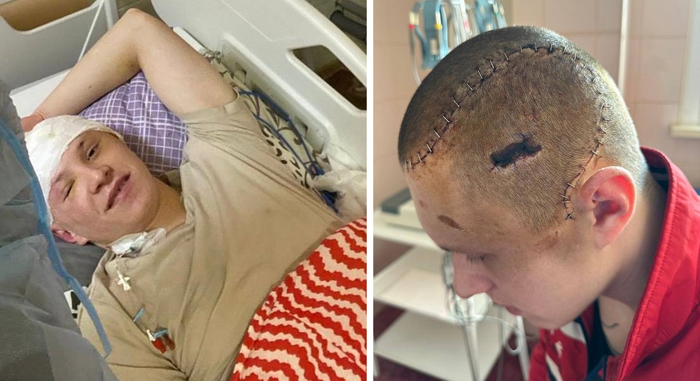 ПІДТРИМАТИ РЕАБІЛІТАЦІЮ - ДЯКУЄМО

🫡🇺🇦Євгеній Гаврилейко, позивний #STARLINK
81-ша окрема аеромобільна Слобожанська бригада
докладніше: ctzn24.com/hero/286

- Я вдячний кожному, хто допомагає нам відновлюватися. Хто вкладає в нас сили, час і віру. Бо це не тільки про фізичне