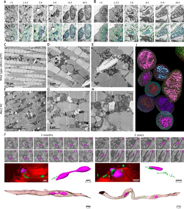 J_Cell_Sci's tweet image. In their Review, Prasanna Katti @KattiiPrasanna, Antentor Hinton, Jr @phdgprotein86 and colleagues discuss how imaging techniques have advanced our understanding of mitochondrial biology.

journals.biologists.com/jcs/article/13…