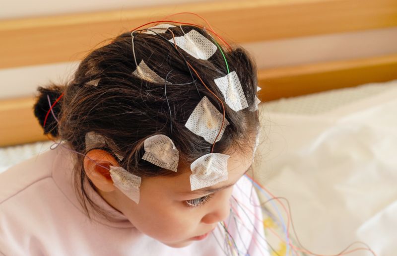 Epilepsy Research Institute tweet media
