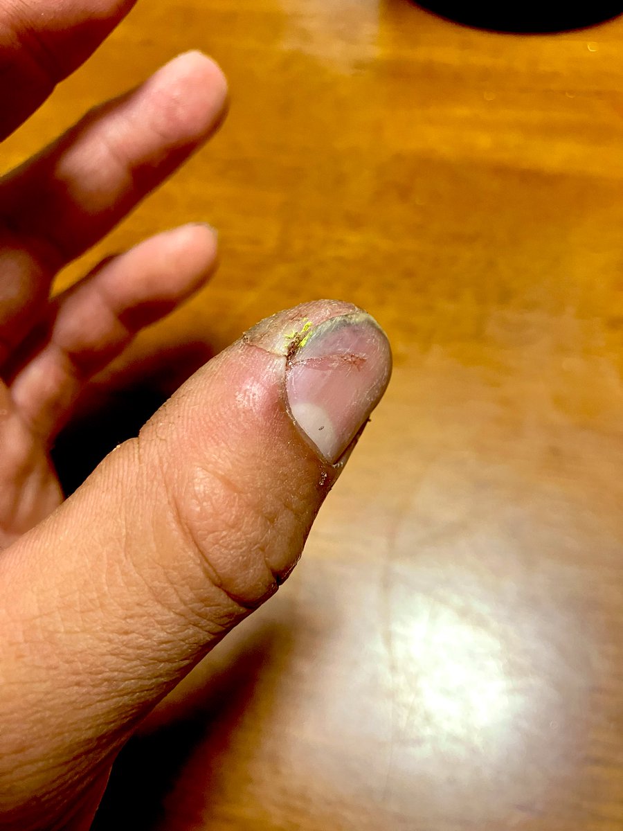 ヒデ🐓🍗 tweet media