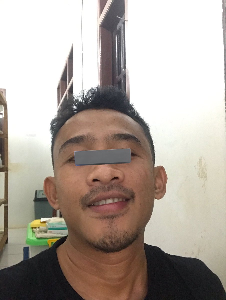 TLD_Survive's tweet image. Kita usahakan menua dengan slayyyy

investasi penggunaan Retinal sebagai anti aging harianmu 😘

#AntiAging #Retinal #Skincare #Loveyourself