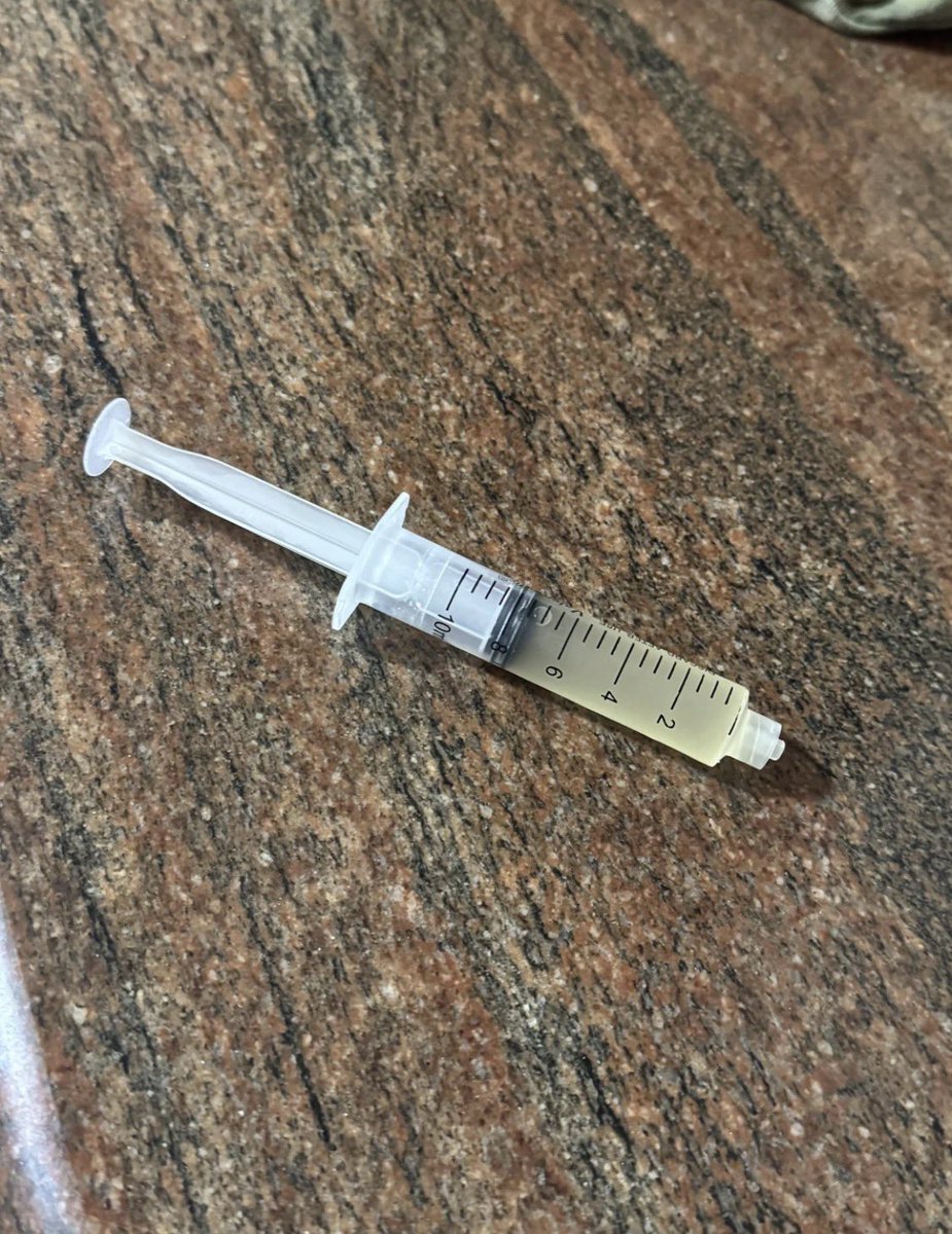 usglogisti12914's tweet image. 50mg 5 minutes ago

I disolved 0.5g of 2CB powder in 10ml of vodka and took 1ml with a friend. 1ml each so around 50mg each. 

What should I expect? I would be reading this while on the high and updating #drugtwt #2cb