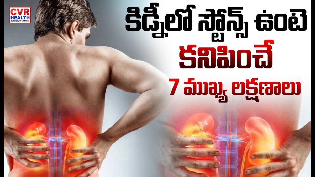 HealthCvr's tweet image. కిడ్నీలో రాళ్లు ఉన్నట్టే కనిపించే 7 ముఖ్య లక్షణాలు | Symptoms Of Kidney Stones In Body | CVR HEALTH

#kidneyhealth #healthproblems #healthtips #cvrhealth
Watch Video&amp;gt;&amp;gt;facebook.com/share/v/18Qbfi…