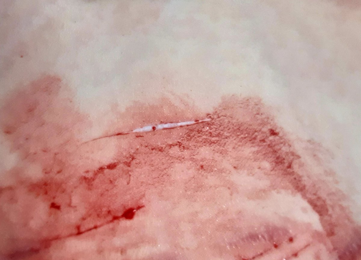 Simon Henriksson of shtwt tweet media