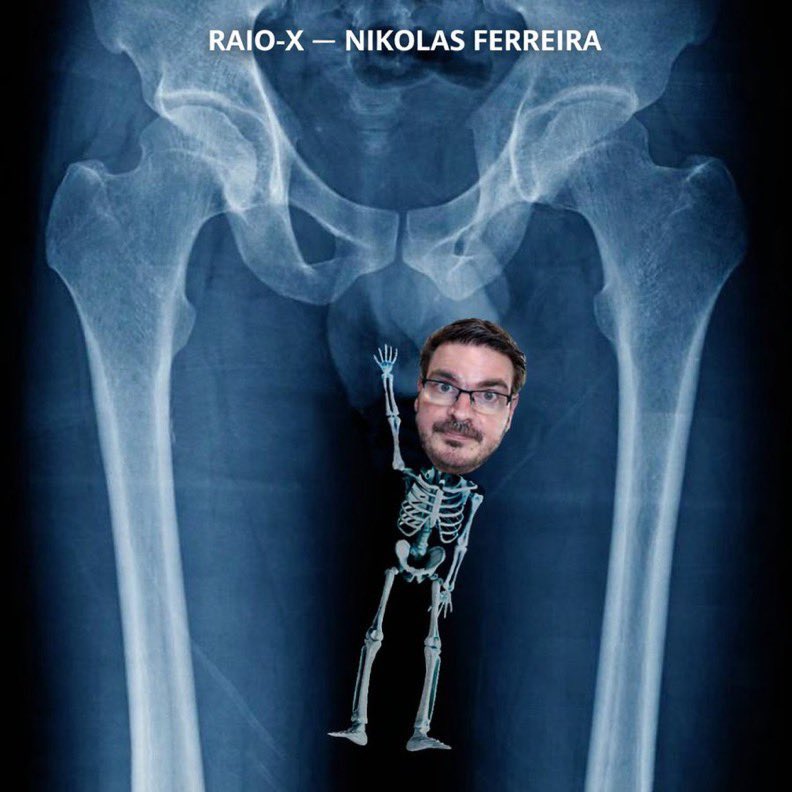 <a href="/Rconstantino/">Rodrigo Constantino</a> Usando o método do consórcio pra atacar Eduardo. 
Como você é podre! 🤮