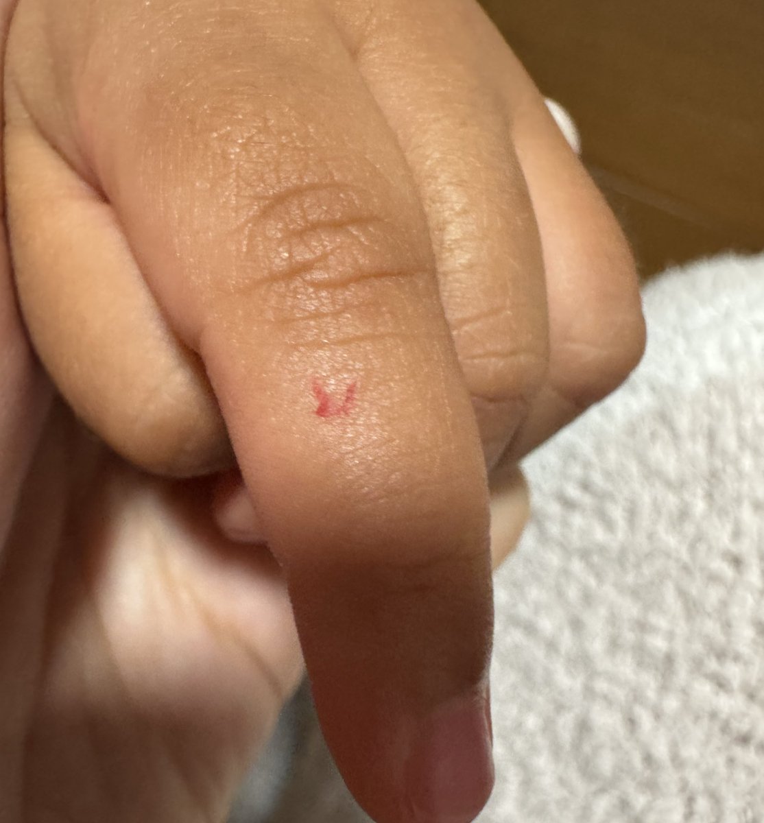 mitaro0427's tweet photo. 「ままーいたいしたーあんぱんまんのばんそうこうはってー」って指みせてきて、一瞬え！ってなったけど、よく見て匂い嗅いだら、いちご🍓
なんともいえない嘘つくようになってきて困ったなあ🤔🤔🤔 https://t.co/eSgtIazLQr