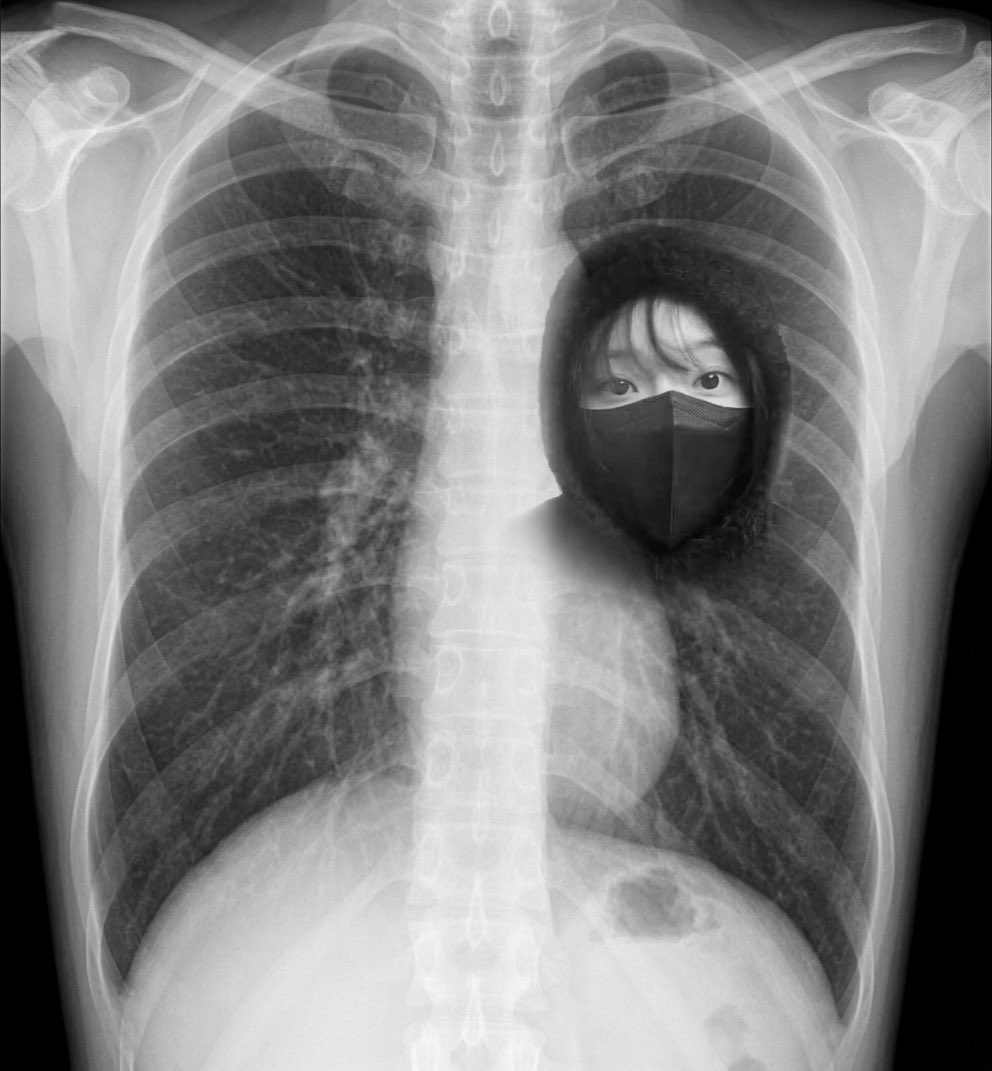 쩡숙자 tweet media