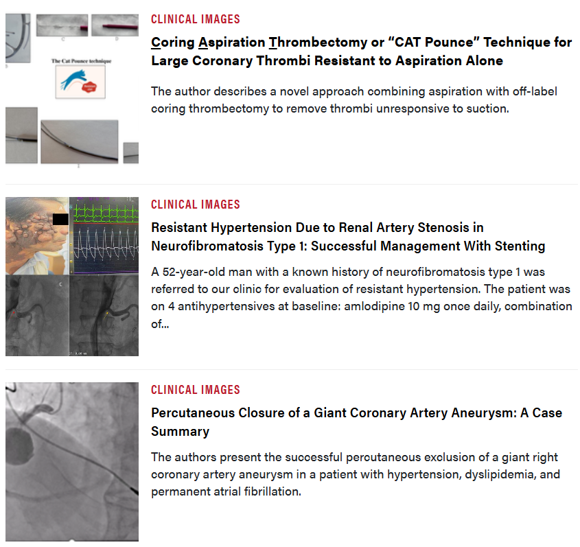Journal of Invasive Cardiology tweet media